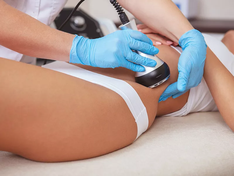 Lipocavitação em Santos
